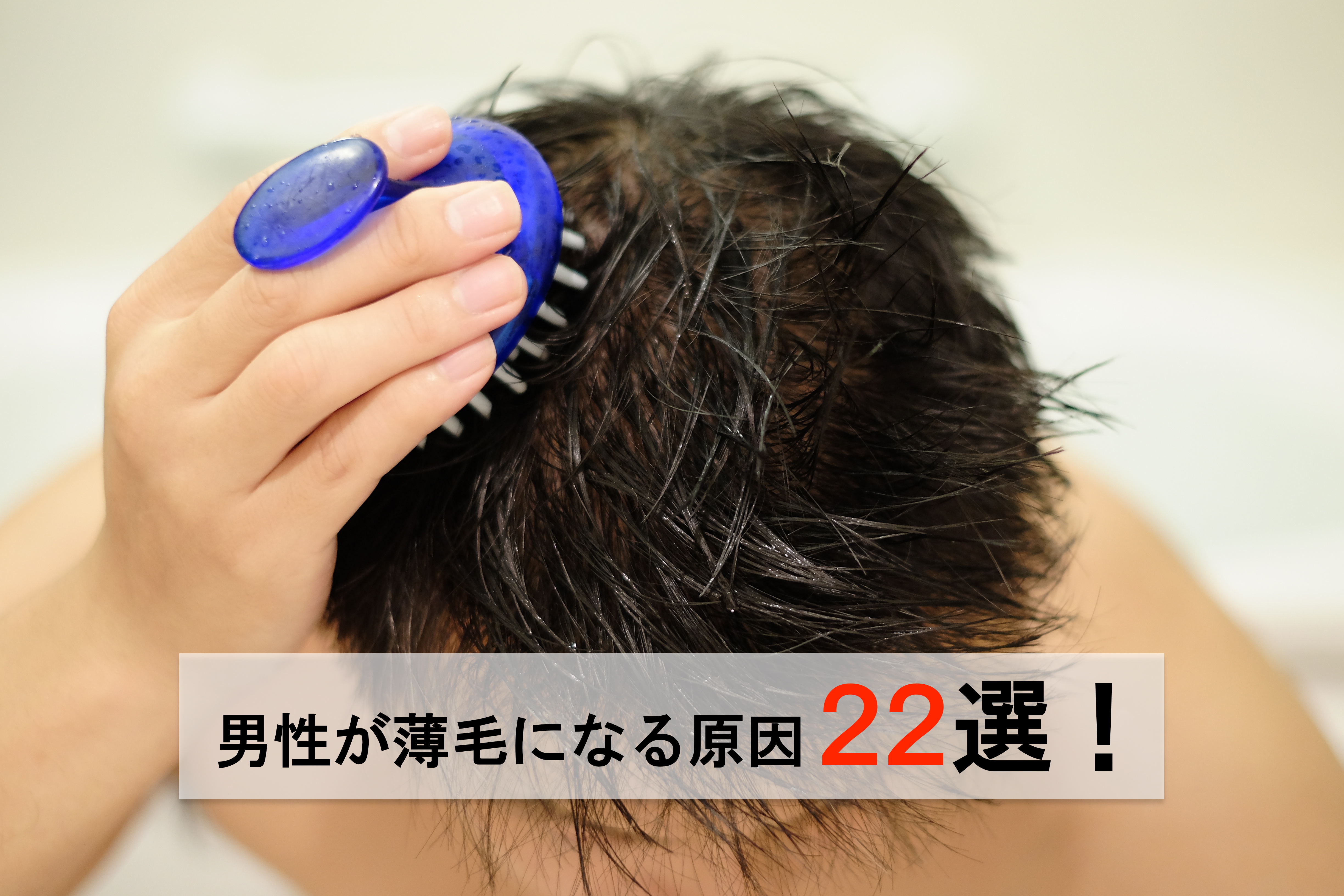 男性が薄毛になる原因22選のアイキャッチ画像