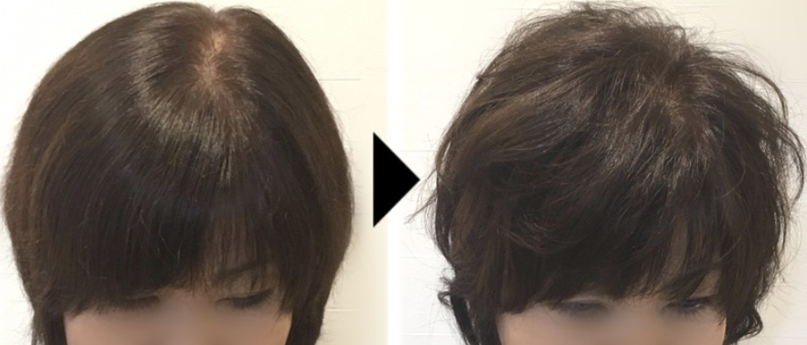 当サロンは、特許増毛技術である「増毛エクステ」の施術ができます。気になる髪のボリューム「前髪・つむじ割れ・トップ」も即日解決できます。