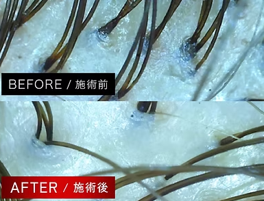 GAGAHIRANOの育毛ケアで、実感されているお客様多数！ 多くの方が施術を通じて、目に見える変化を体験されています。