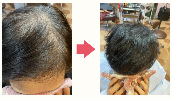 before/after