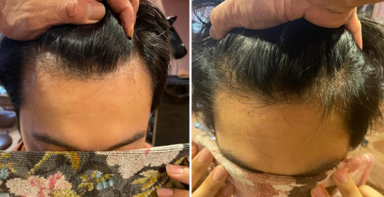 before/after