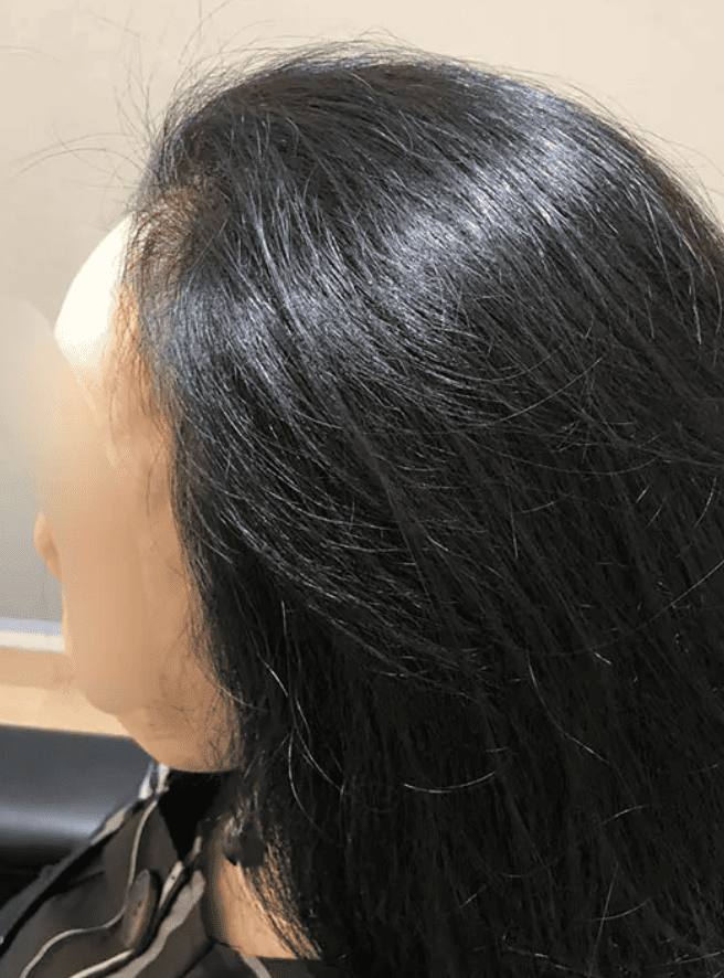 増毛エクステ｜PENTAGONの増毛は“無駄なく、自然に”がモットーです。  PENTAGONでは、美容師として培った高度な技術を活かし、まず薄く見えにくい髪型をしっかりデザインしたうえで増毛エクステを施します。 このアプローチにより、必要以上に増毛することなく自然な仕上がりが実現でき、無駄なコストを抑えることが可能です。  「自然に見せたい」「費用をかけすぎたくない」そんな方にこそ、PENTAGONの増毛はおすすめです。 まずはお気軽にご相談ください。