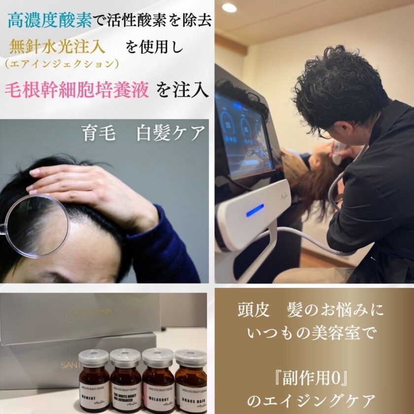 ミコステラは、針を使用せずに有効成分を頭皮深層へ浸透させる先進的エアインジェクション技術です。  高速ジェットと高濃度酸素を組み合わせることで、幹細胞上清液などの成分を効率的に毛根部へ導入し、細胞レベルから頭皮環境を最適化。発毛・育毛の可能性を最大限に引き出します。痛みやダウンタイムがなく、安心して継続できる次世代スカルプケアです。