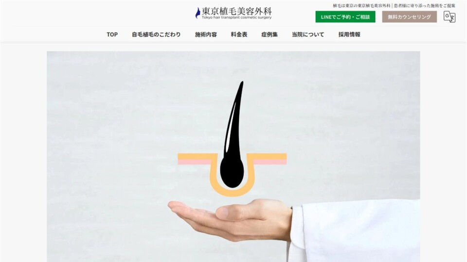 Doctor's hand presenting a stylized hair follicle graphic over a pink/orange line, symbolizing hair transplant services.