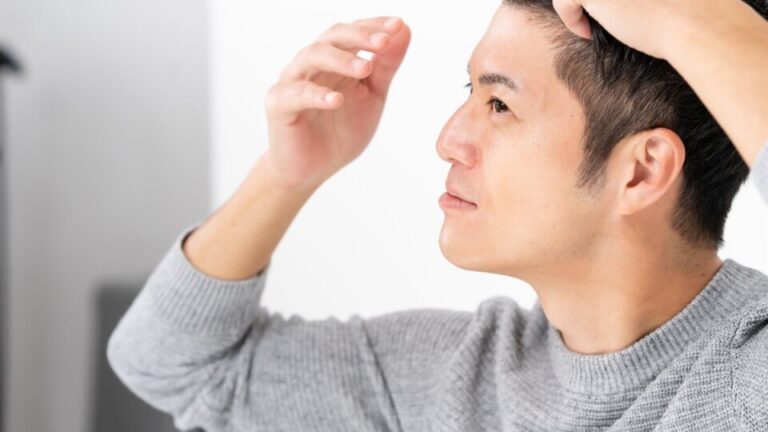 Man in a gray sweater lifts hair to inspect his scalp.