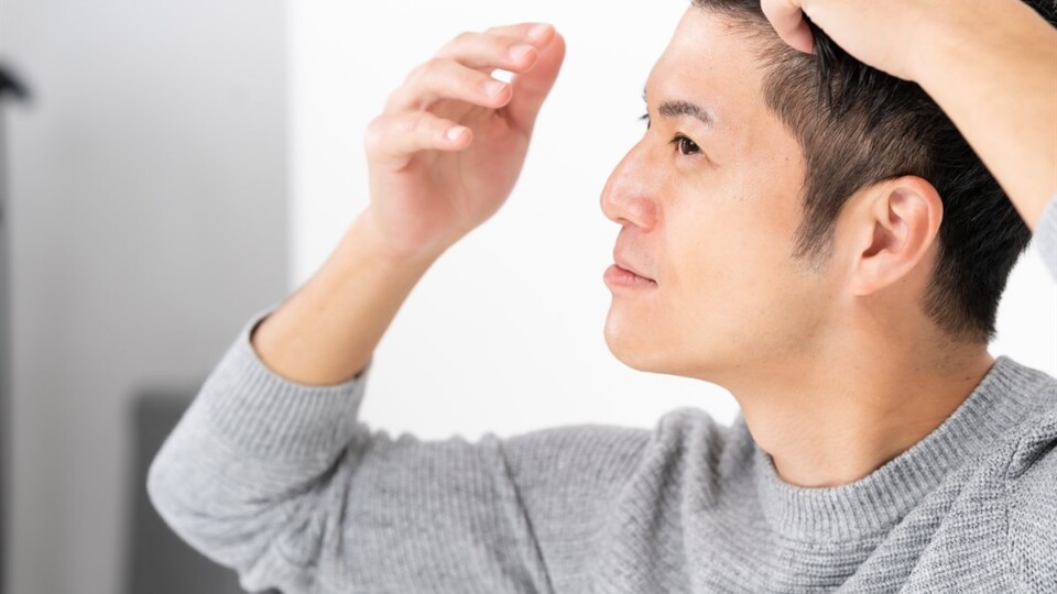 Man in a gray sweater lifts hair to inspect his scalp.